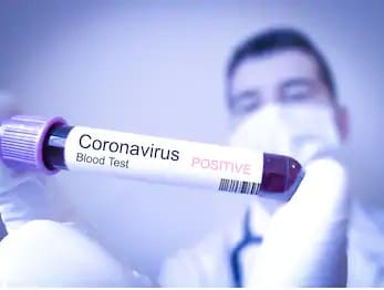 COVID-19 Pandemic update for October 2nd 2020 – The government presents its daily update